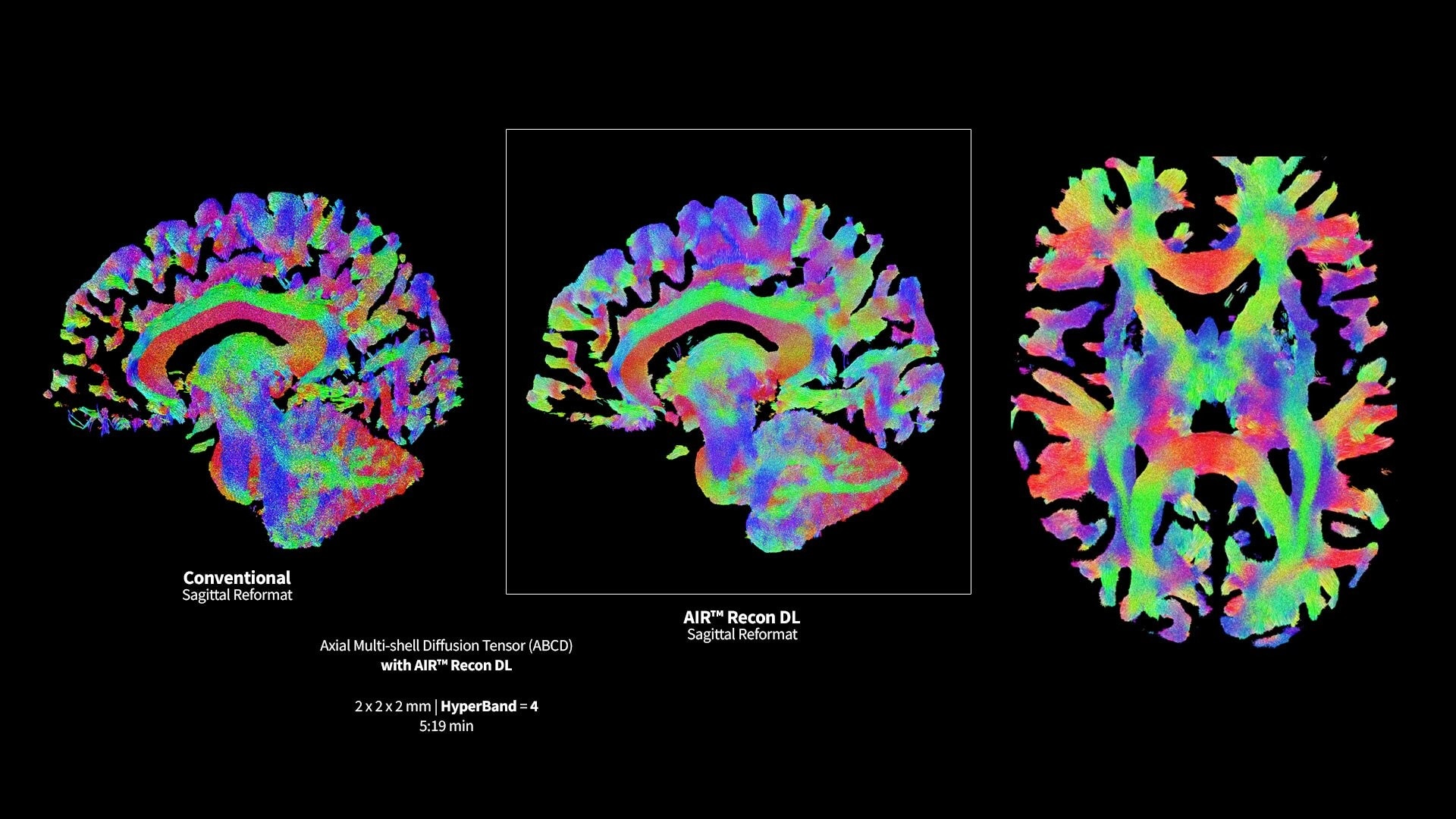 Product Media Carousel Image