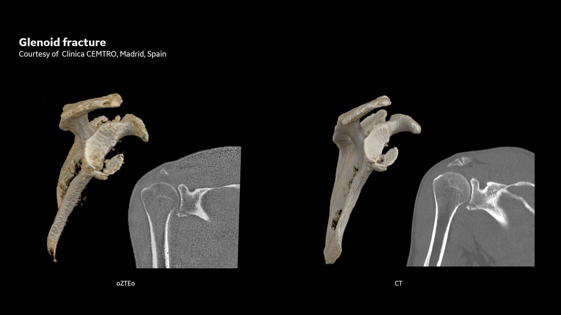 Product Media Carousel Image