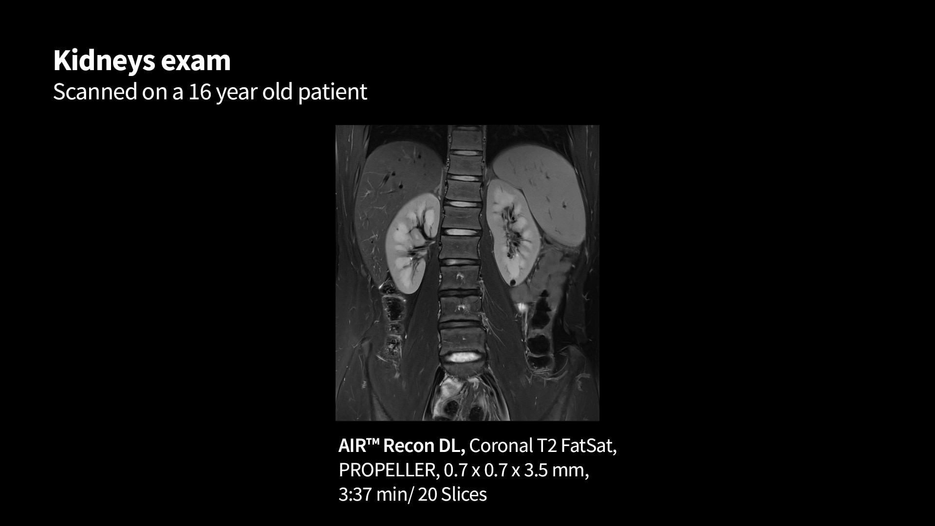 Product Media Carousel Image