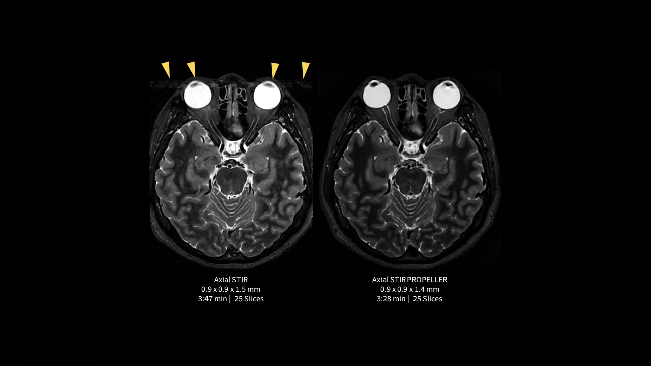 Product Media Carousel Image