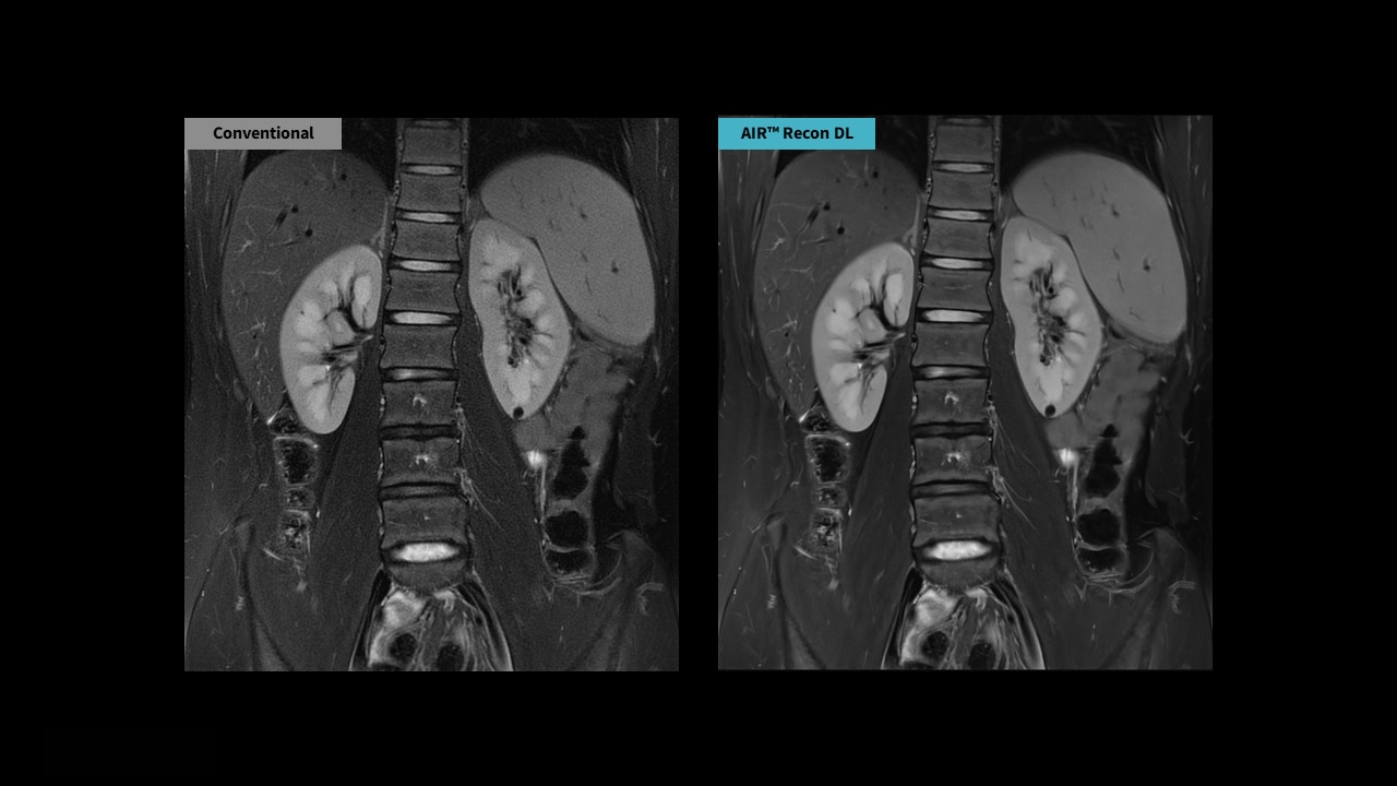 Product Media Carousel Image