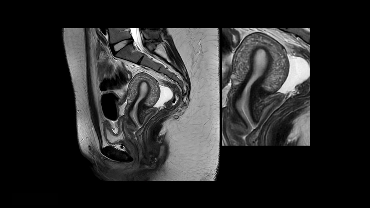 Product Media Carousel Image