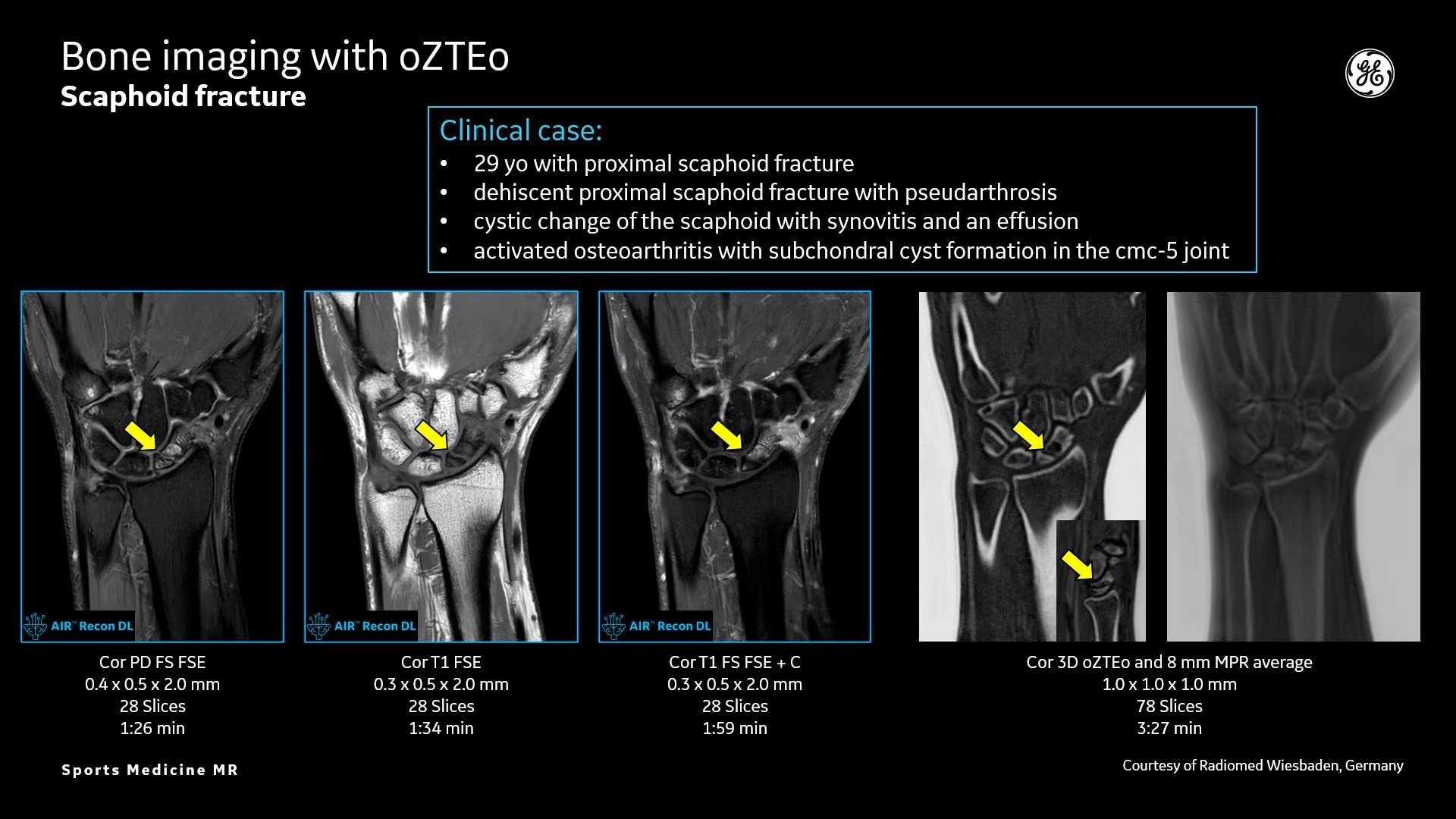 Product Media Carousel Image