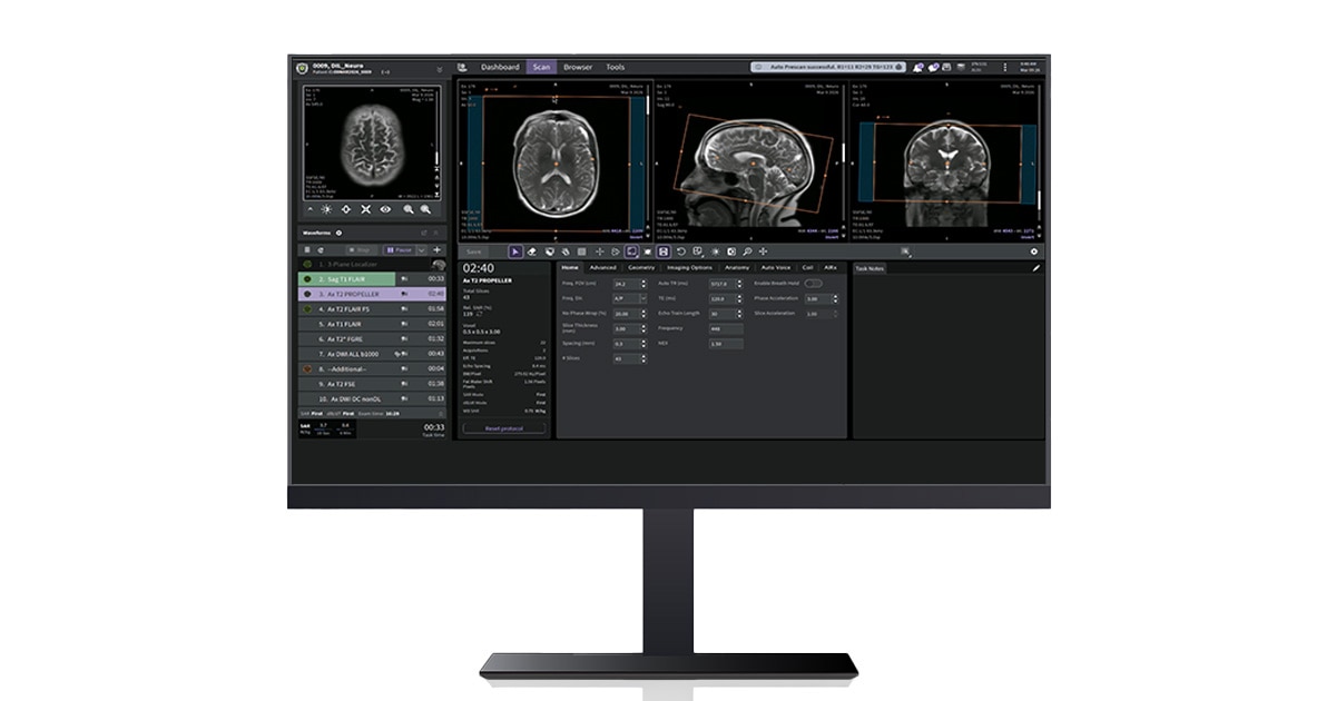 One Interface SIGNA One Interface Upgrade | GE HealthCare (United States)