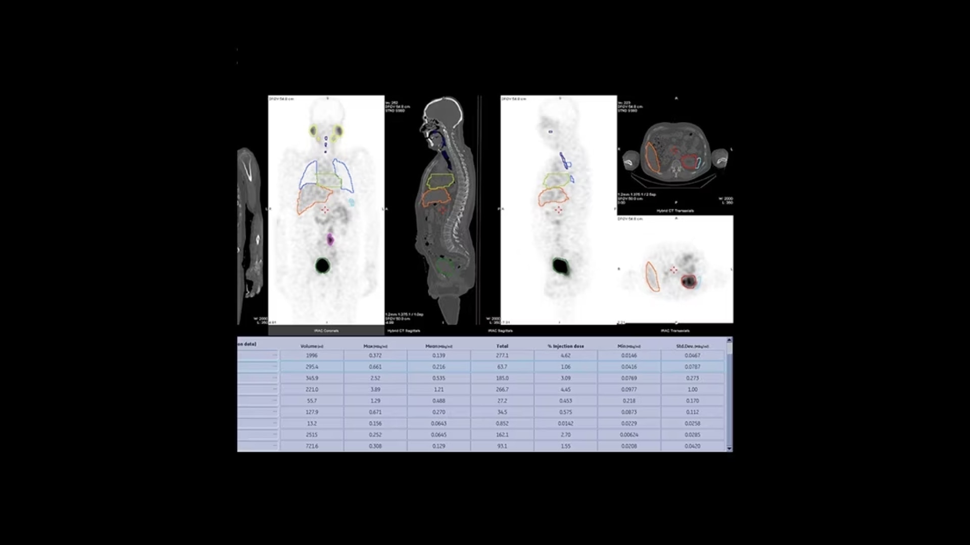 Product Media Carousel Image