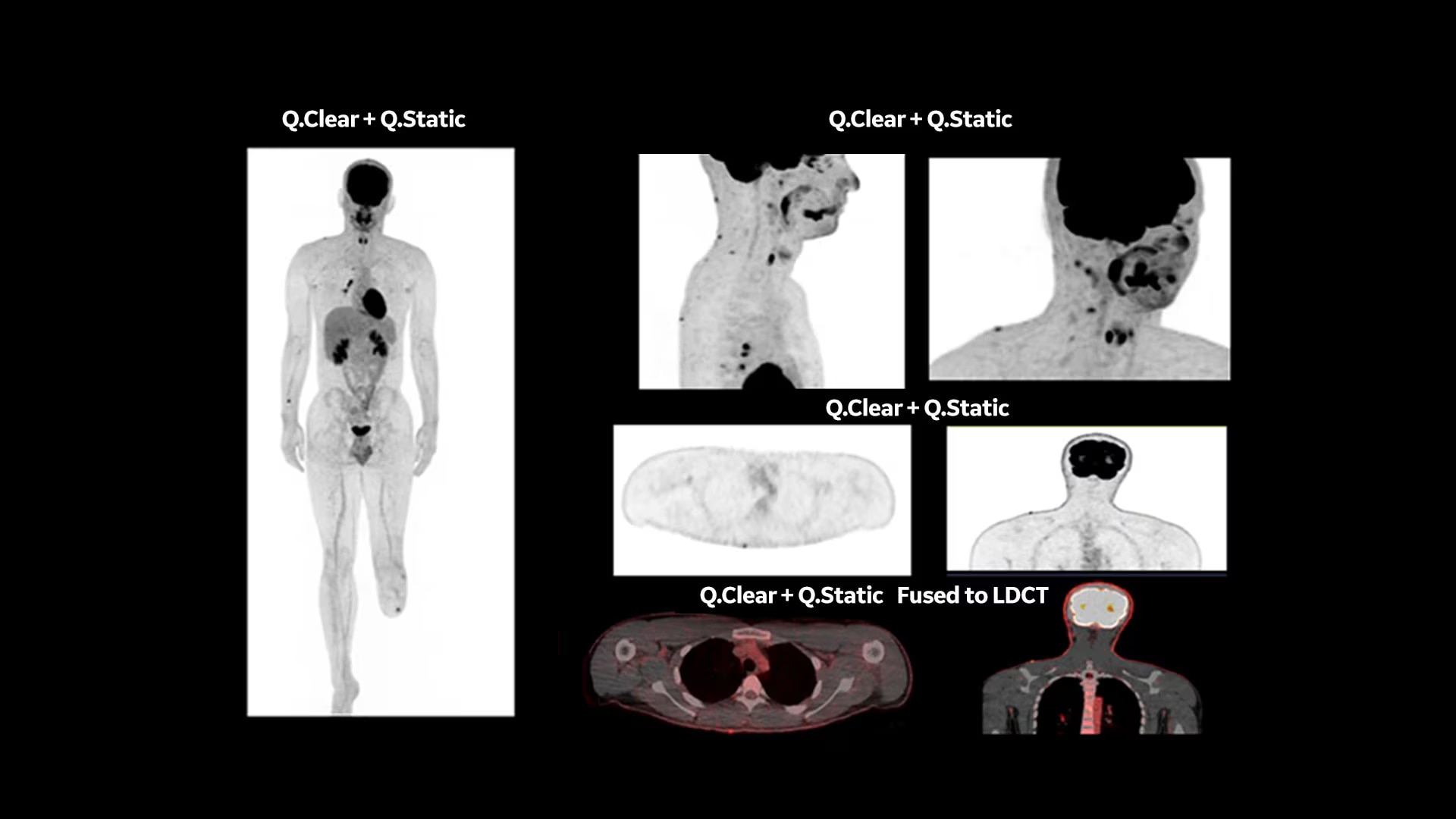 Product Media Carousel Image