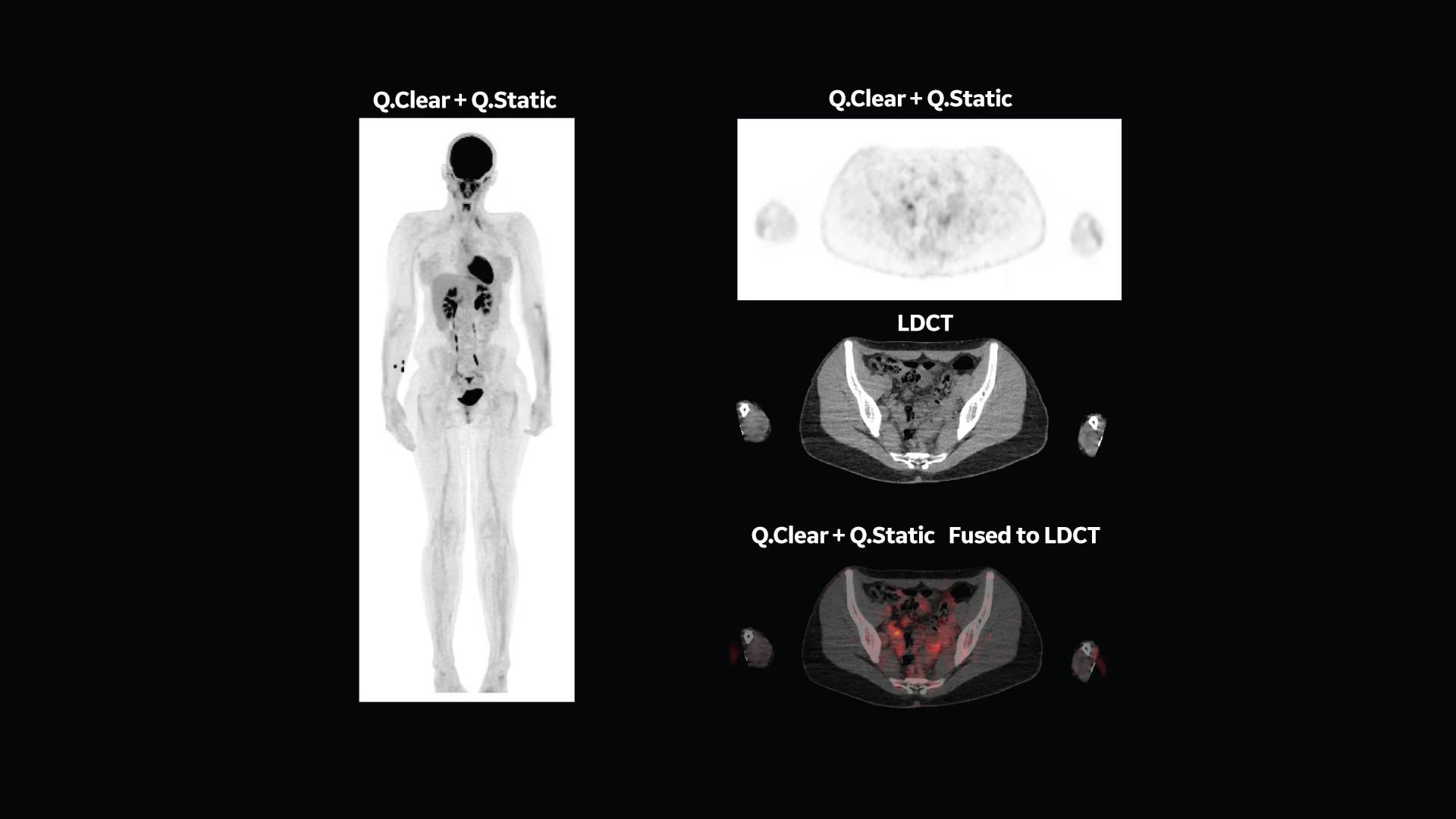 Product Media Carousel Image