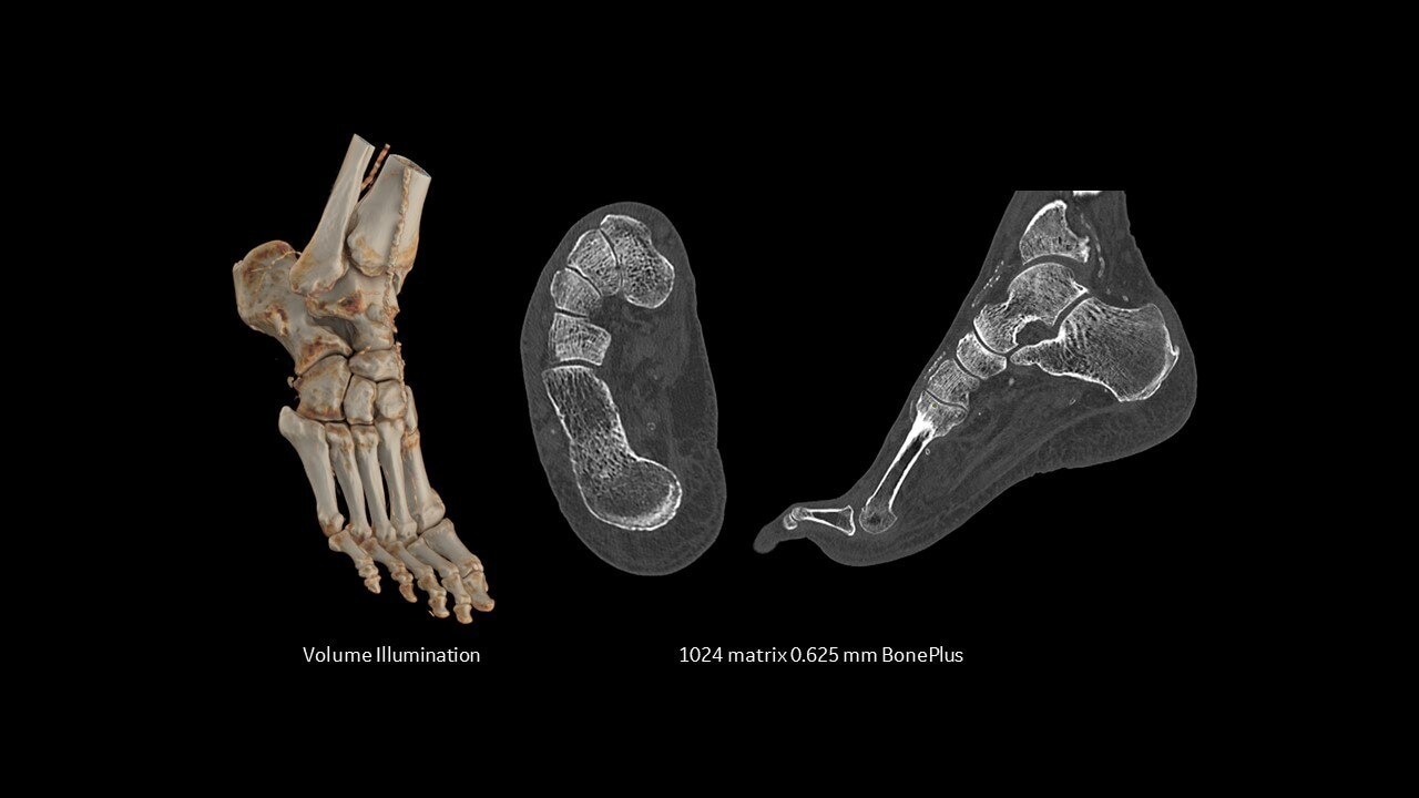Product Media Carousel Image
