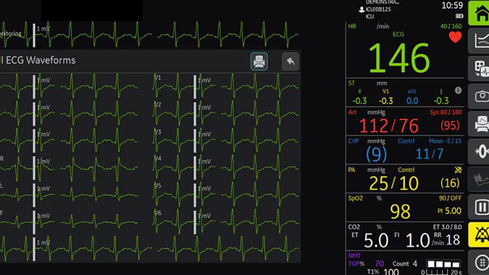 Product Media Carousel Image