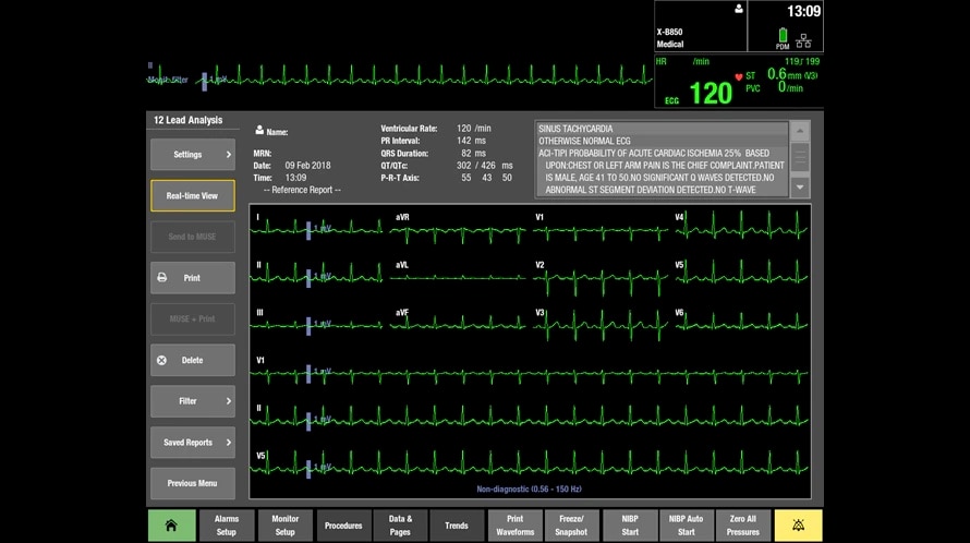 Product Media Carousel Image