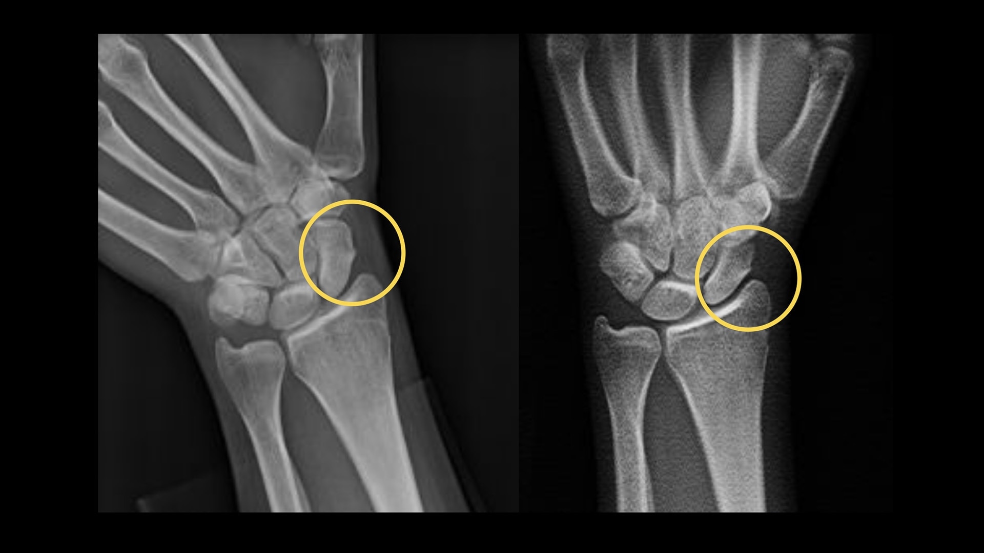 Product Media Carousel Image