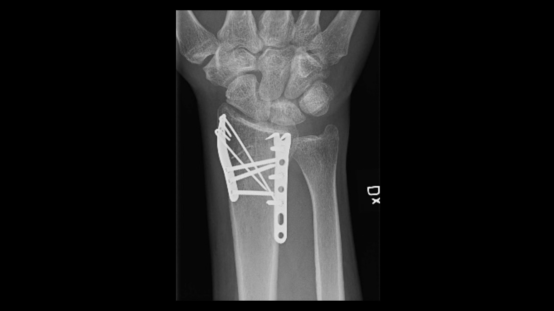 Product Media Carousel Image