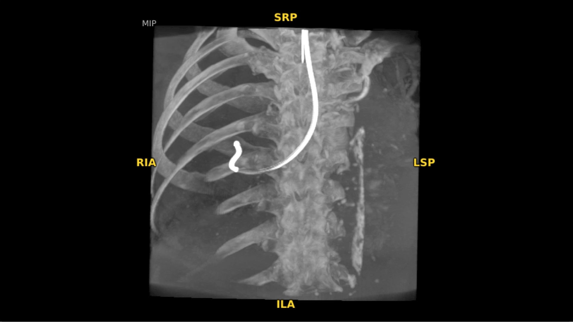 Product Media Carousel Image