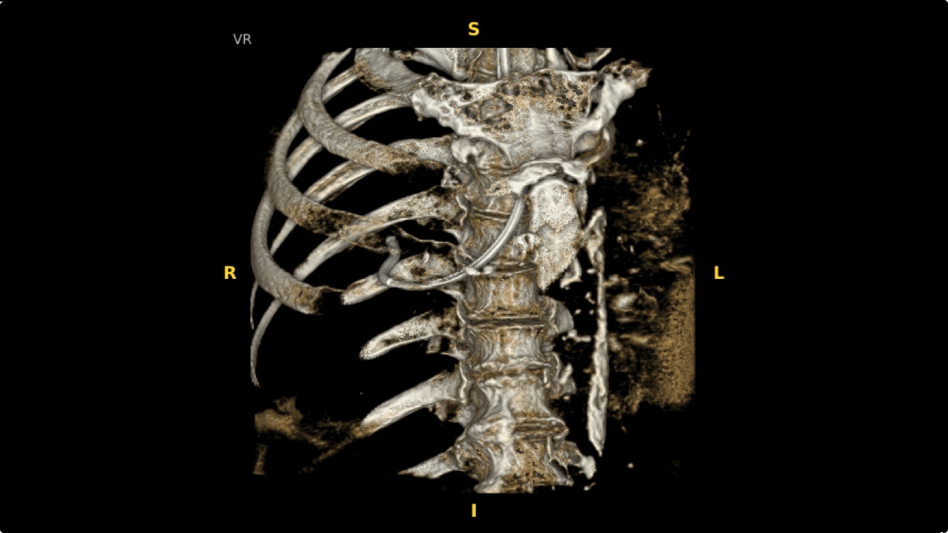 Product Media Carousel Image