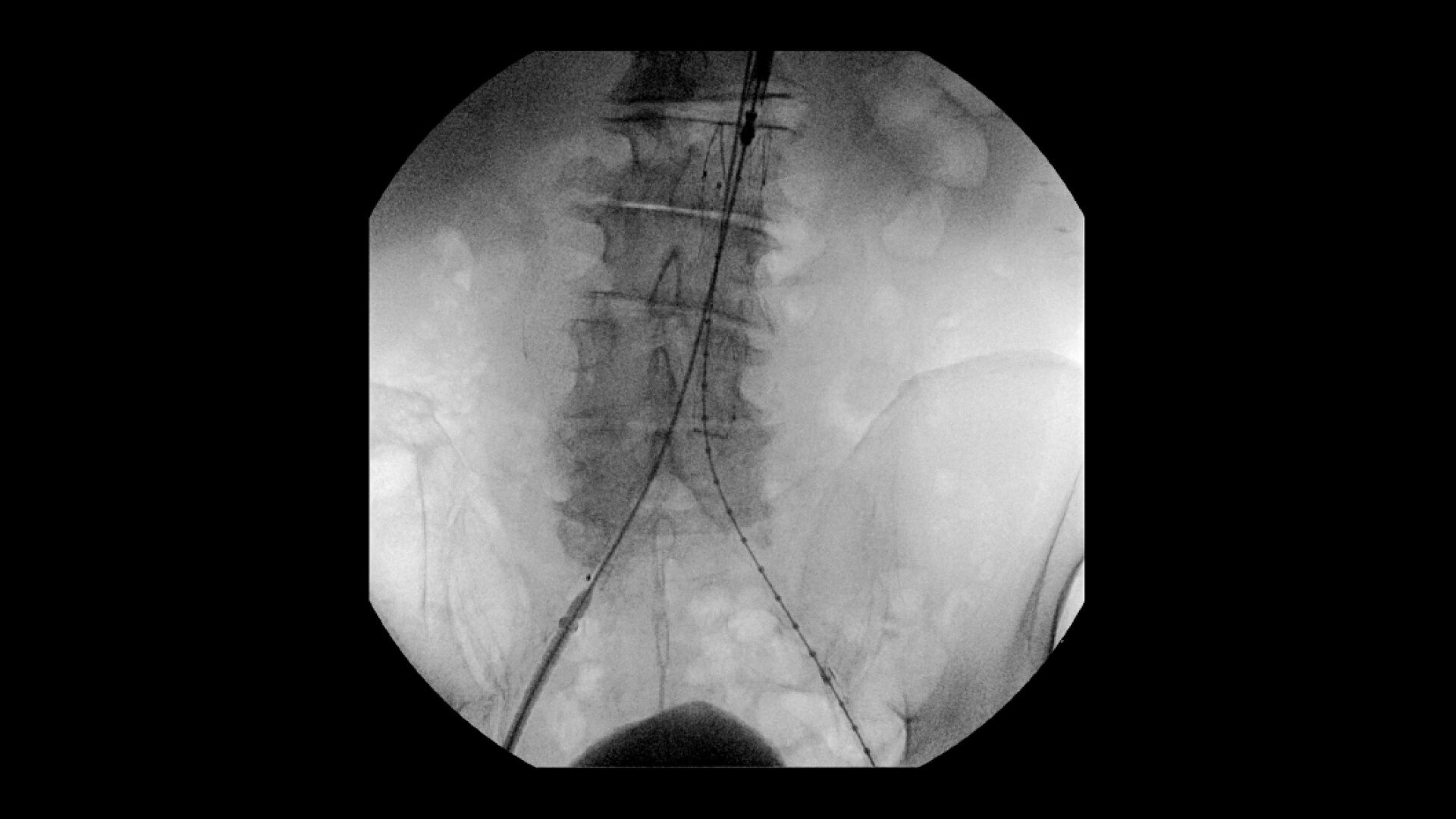 Product Media Carousel Image