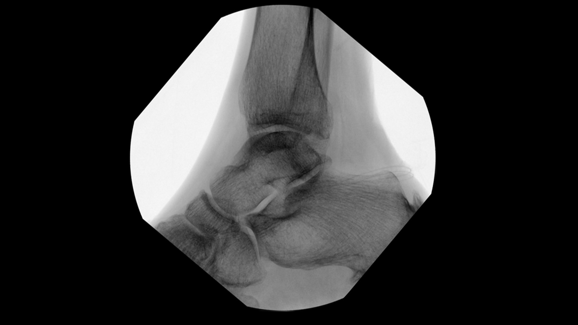 Product Media Carousel Image