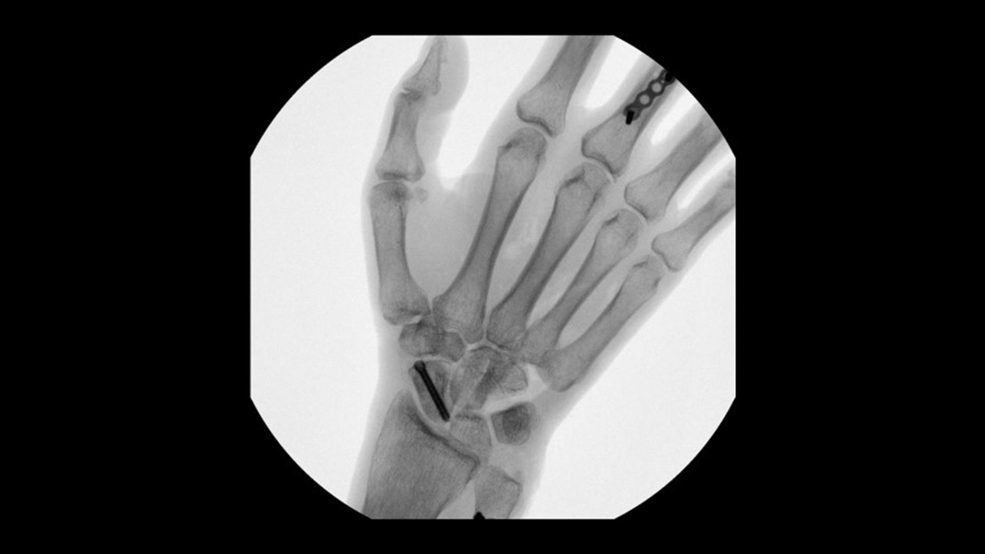 Product Media Carousel Image