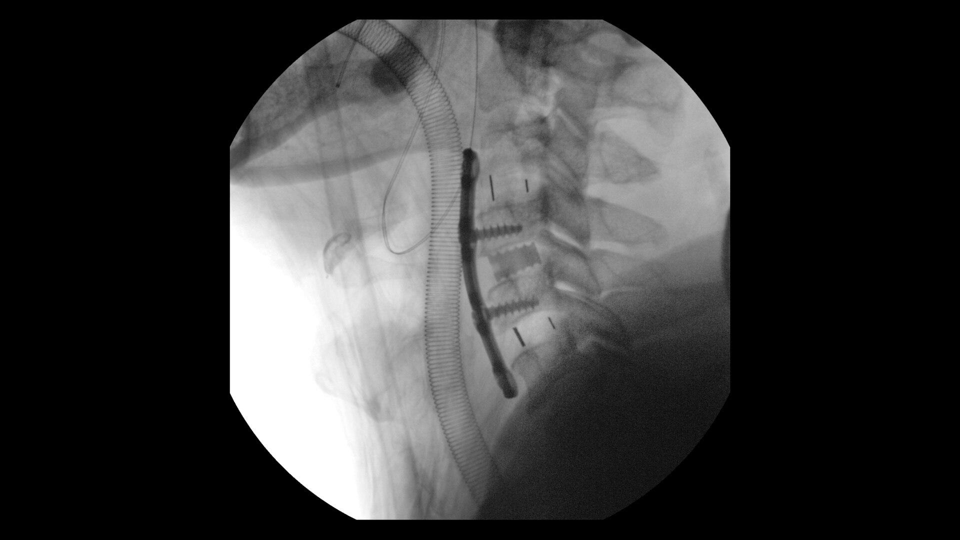 Product Media Carousel Image