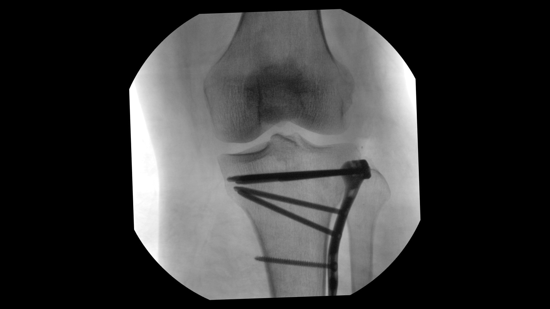 Product Media Carousel Image