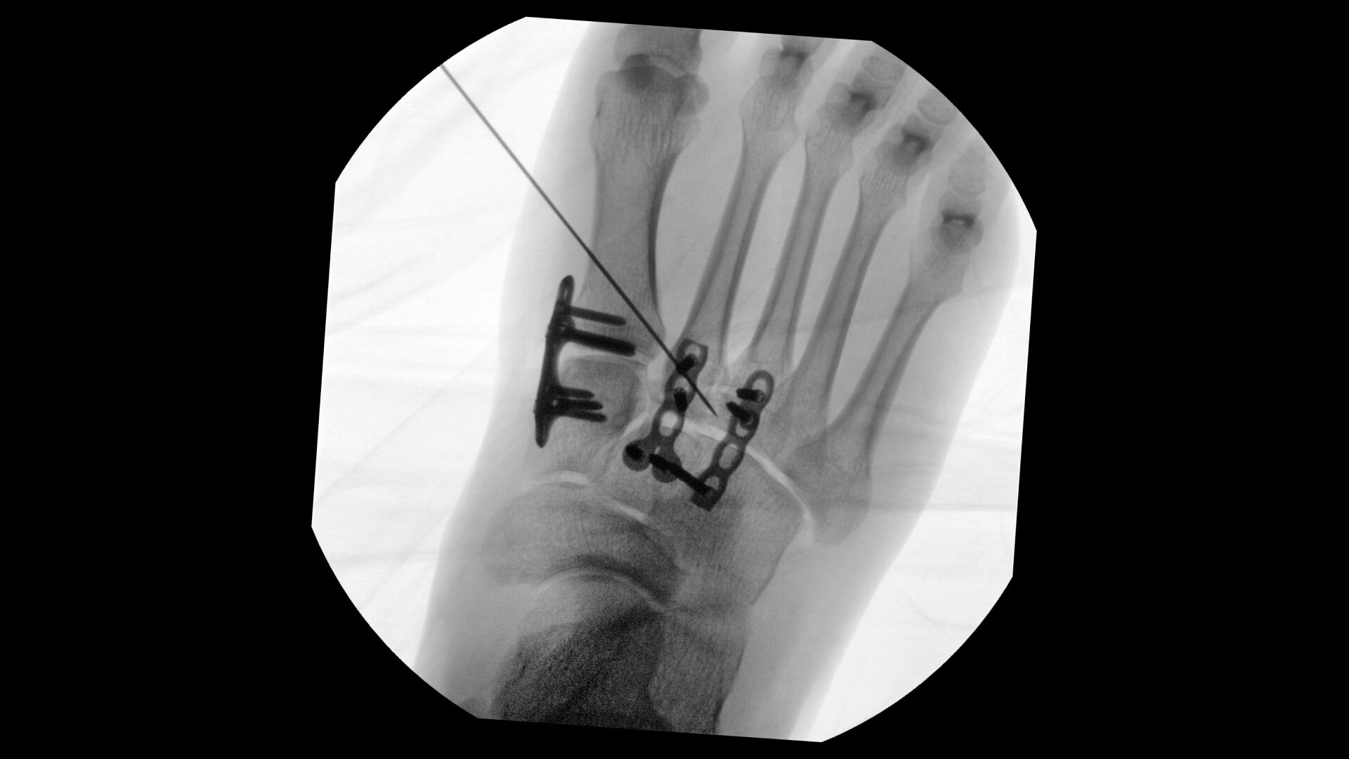 Product Media Carousel Image