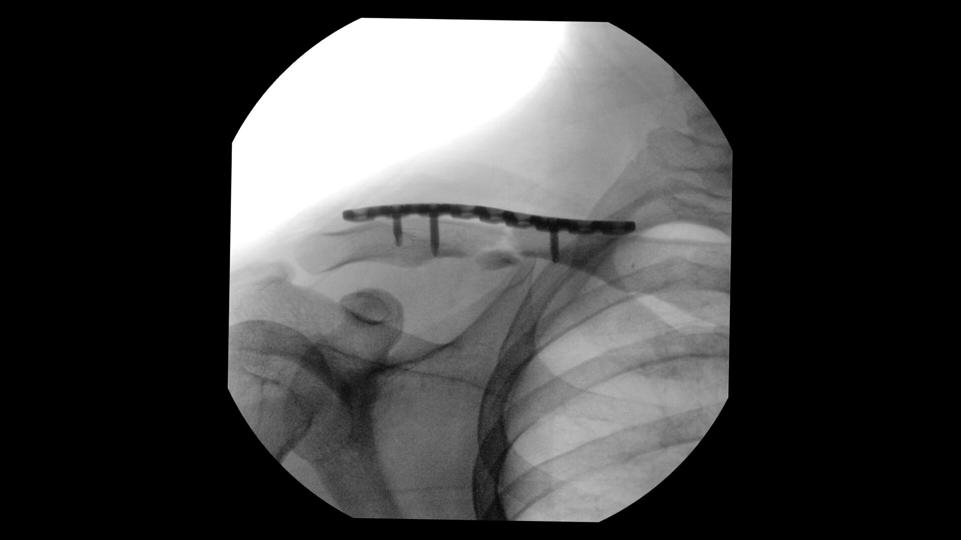 Product Media Carousel Image