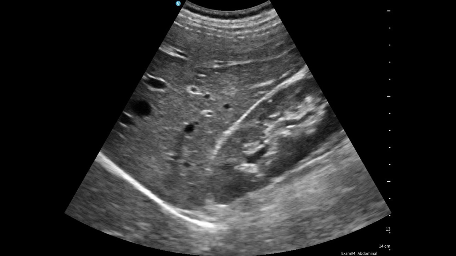 Product Media Carousel Image