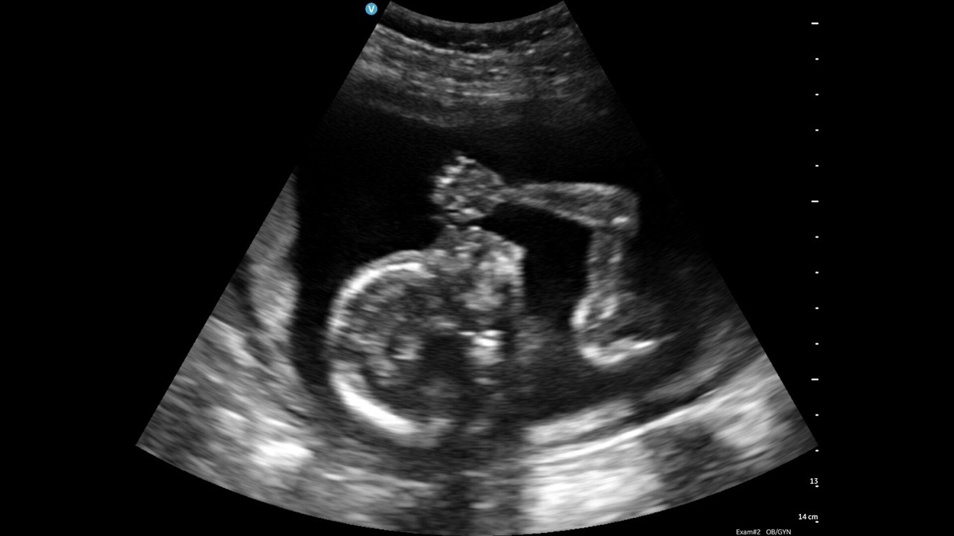 Product Media Carousel Image