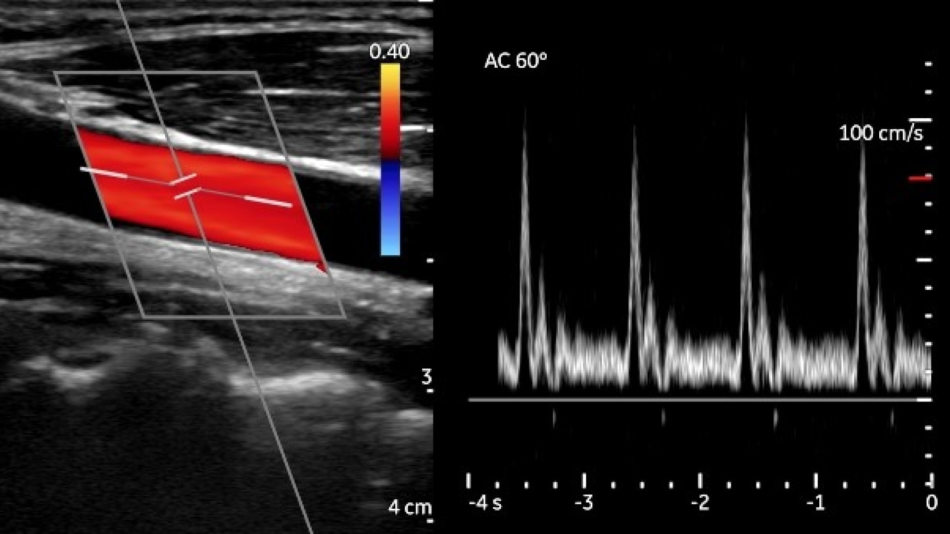 Product Media Carousel Image