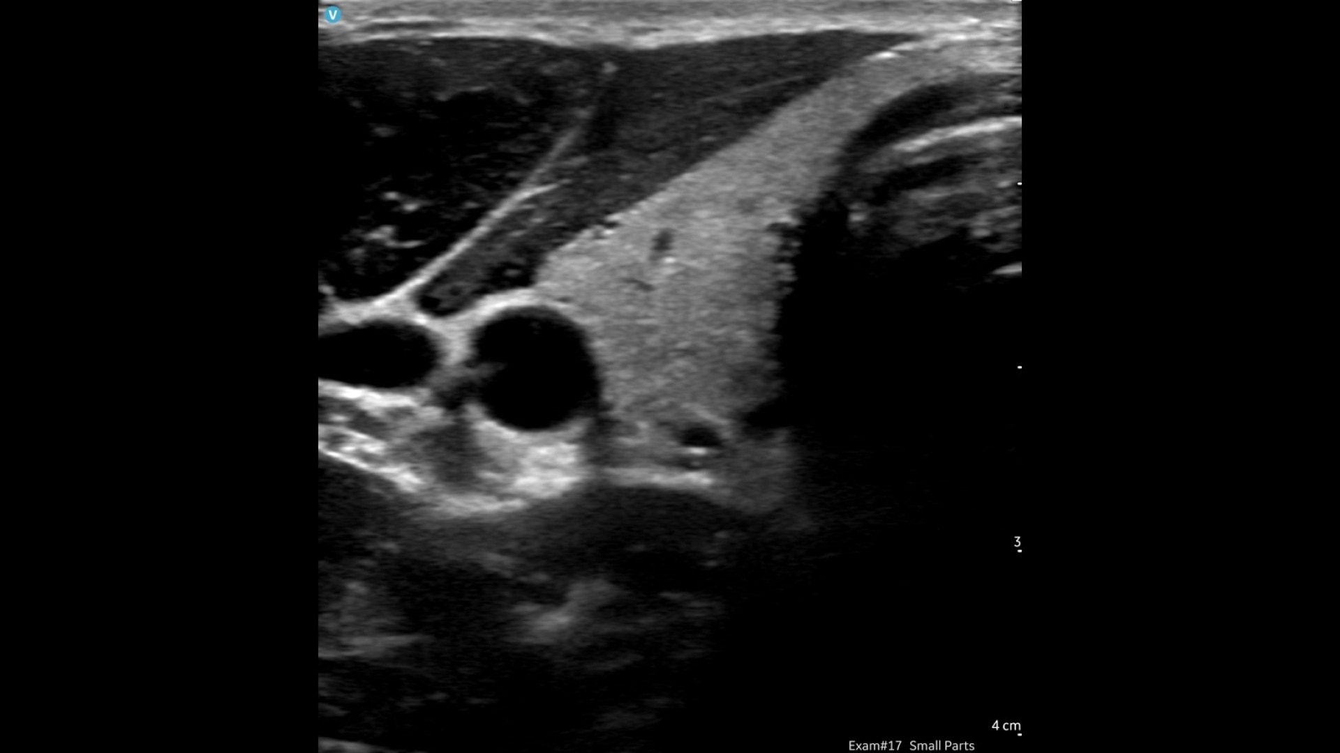 Product Media Carousel Image