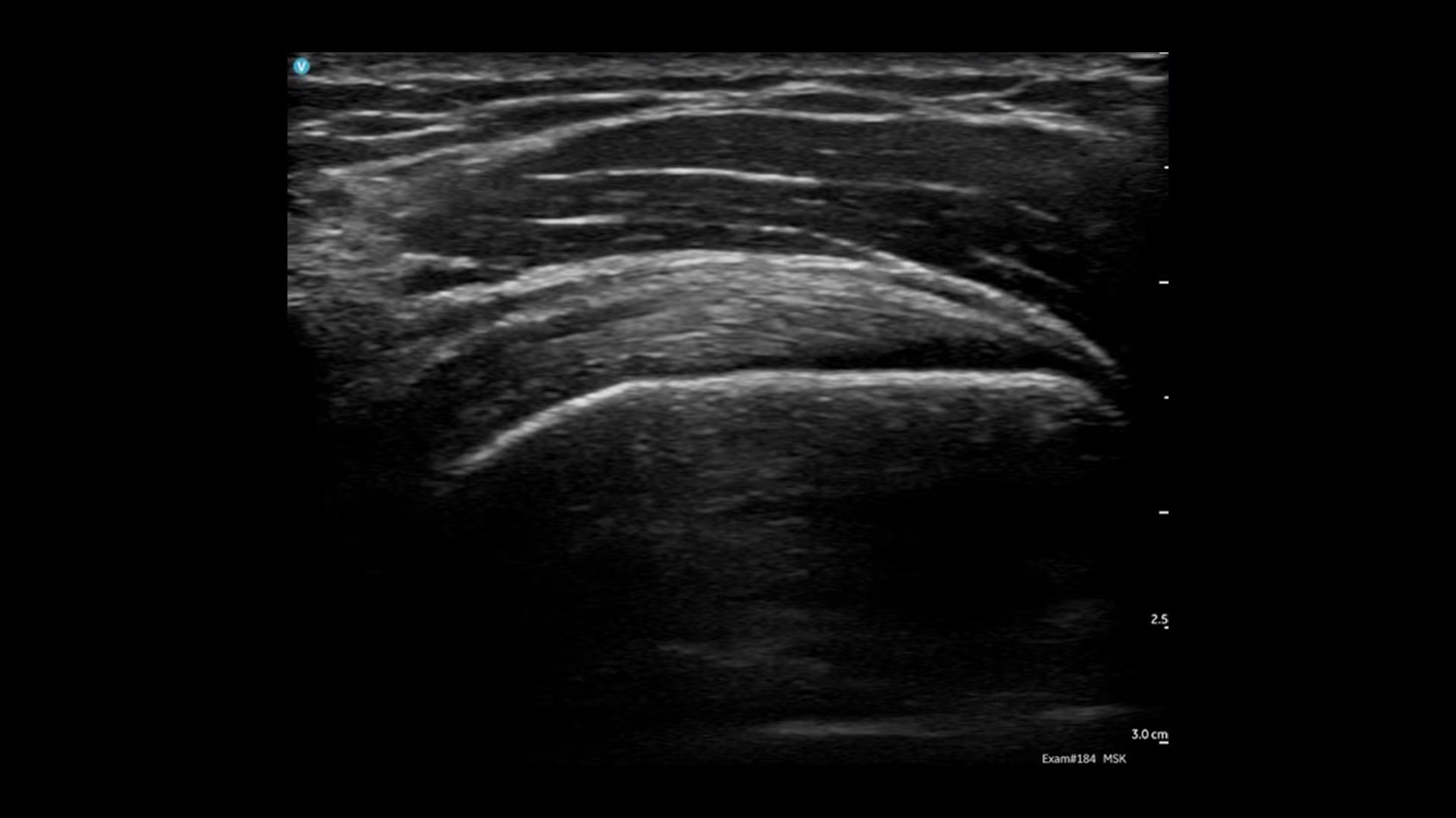 Product Media Carousel Image