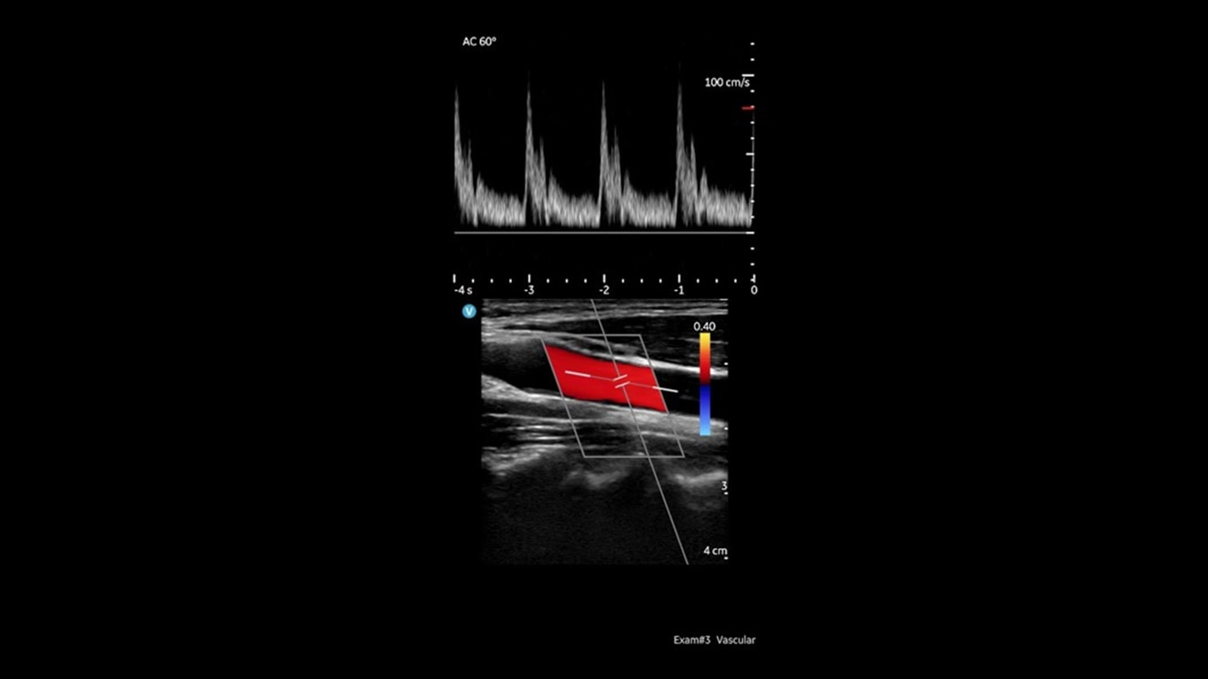 Product Media Carousel Image