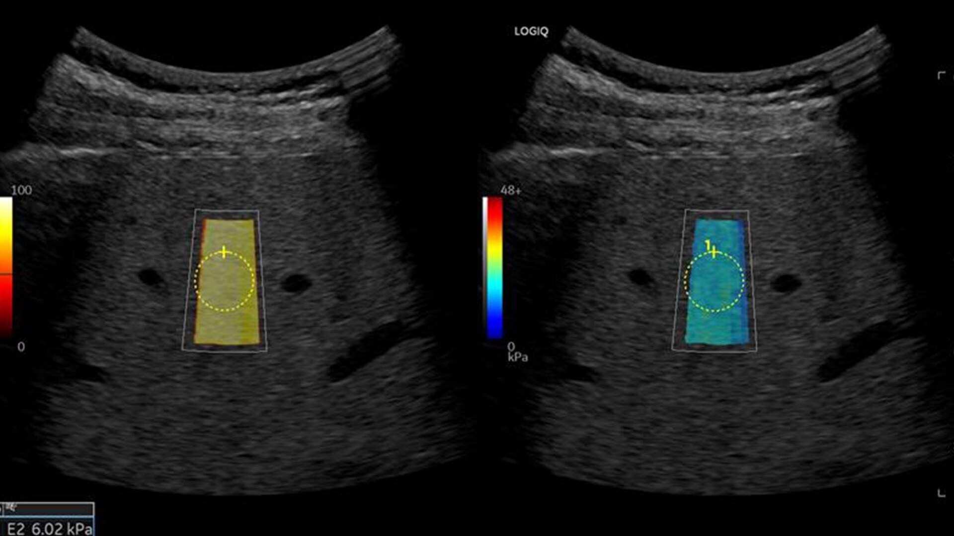 Product Media Carousel Image