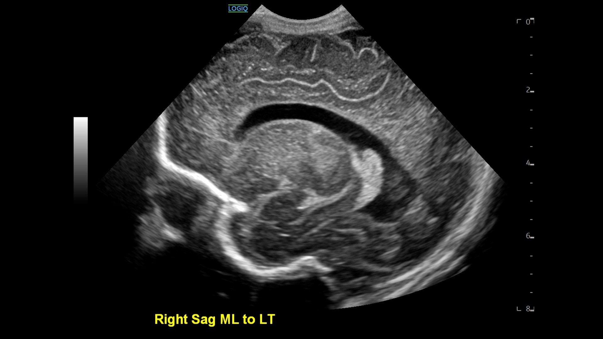 Product Media Carousel Image