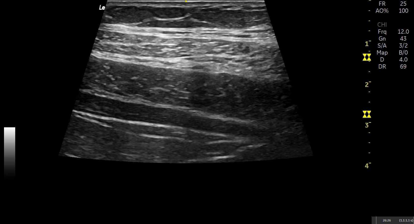 Product Media Carousel Image