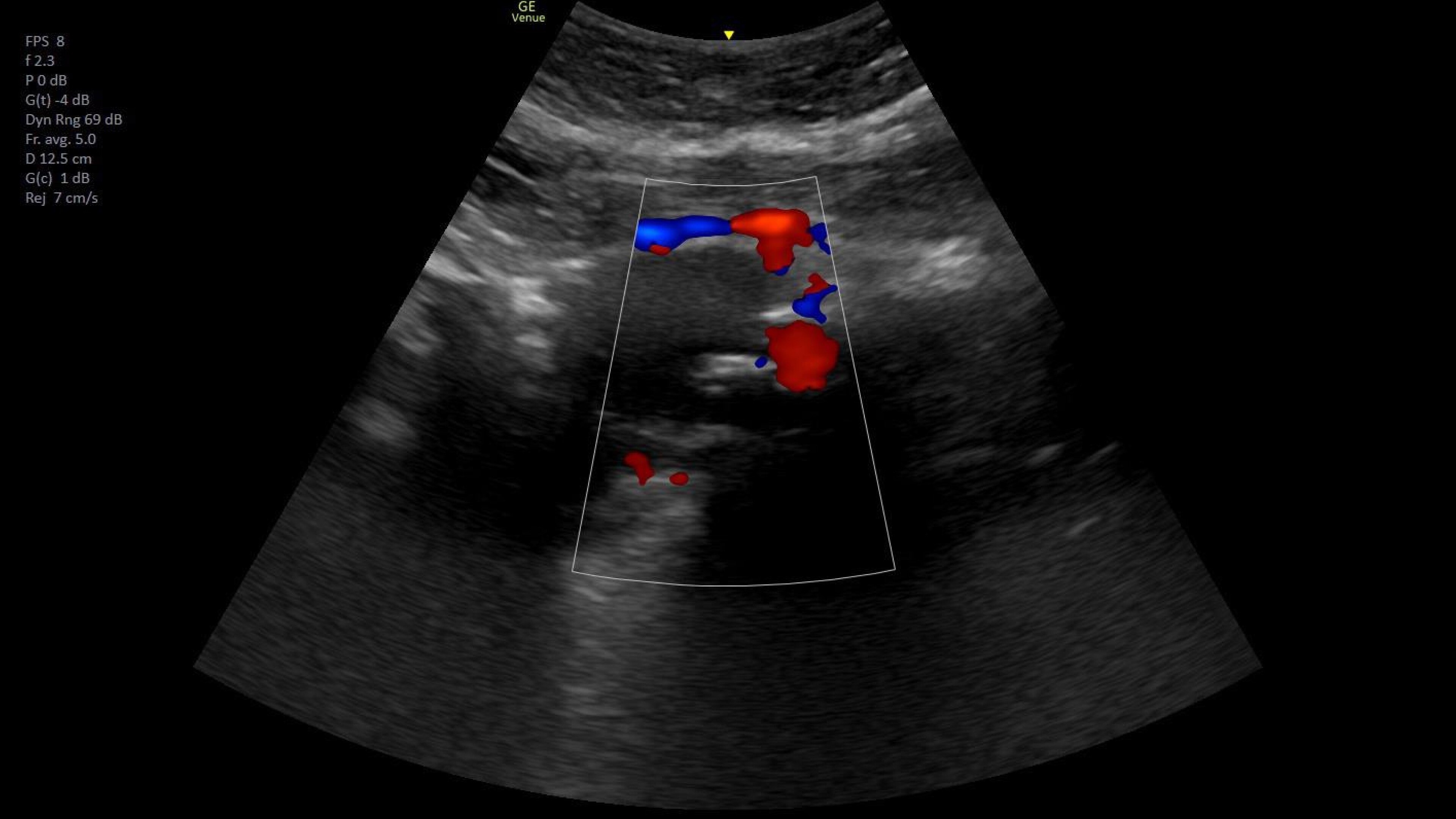 Product Media Carousel Image