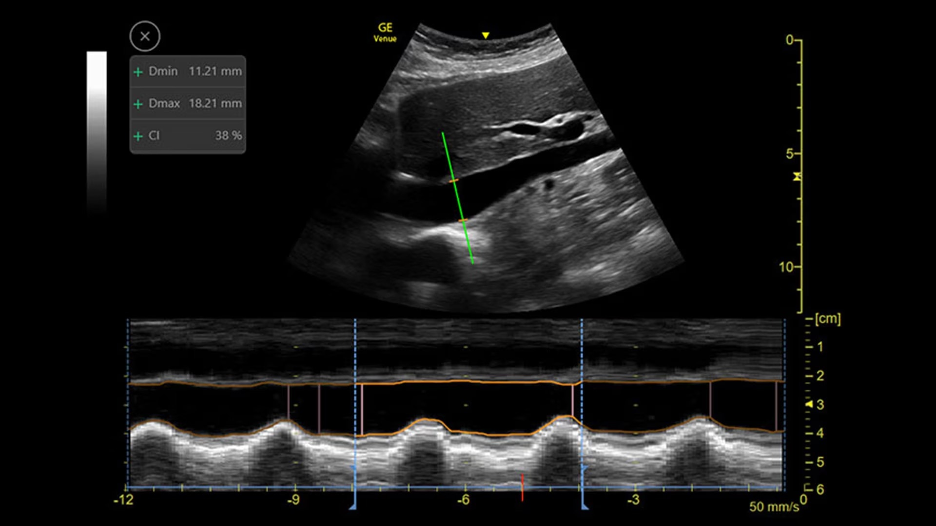 Product Media Carousel Image