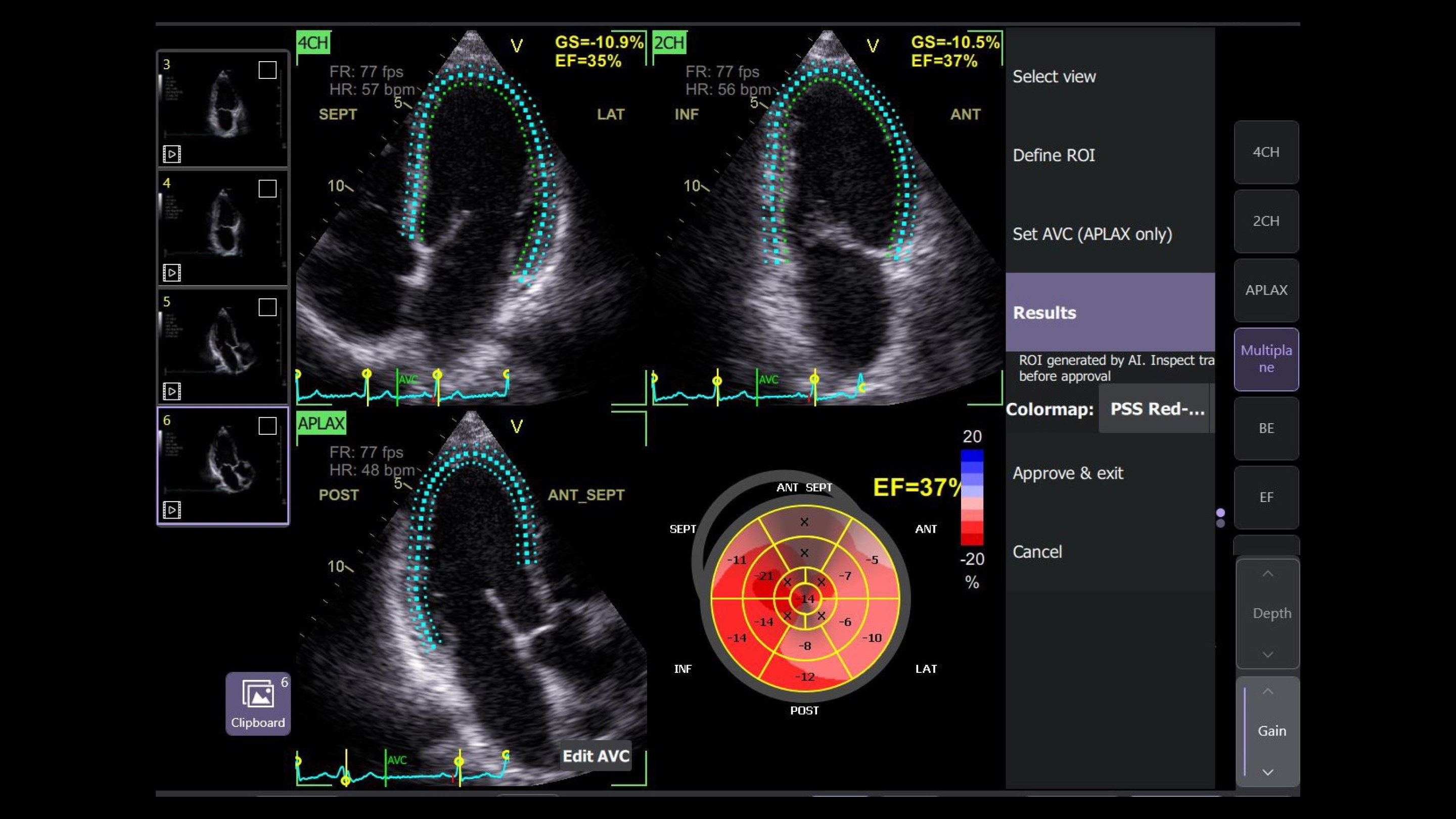 Product Media Carousel Image