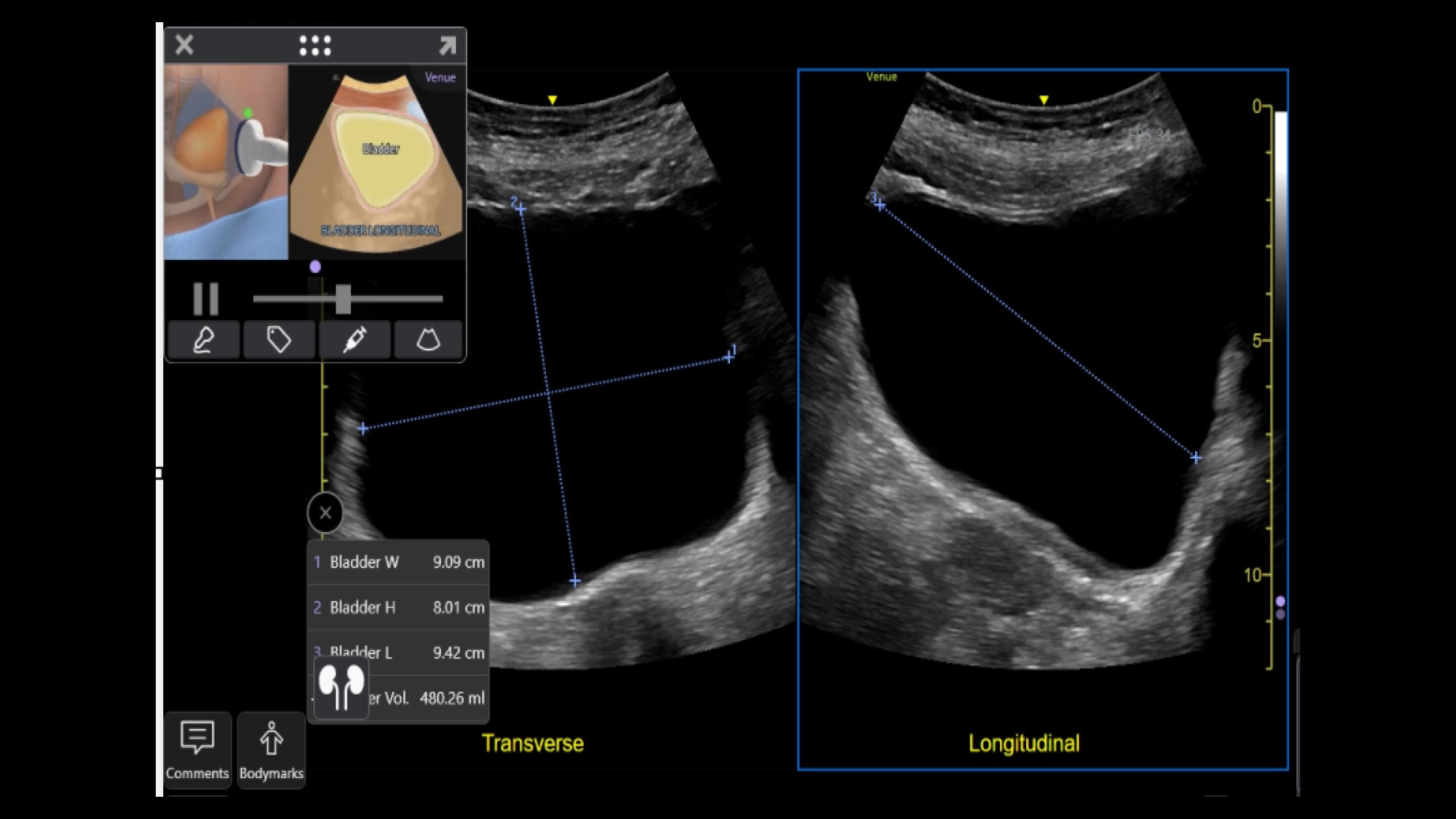Product Media Carousel Image