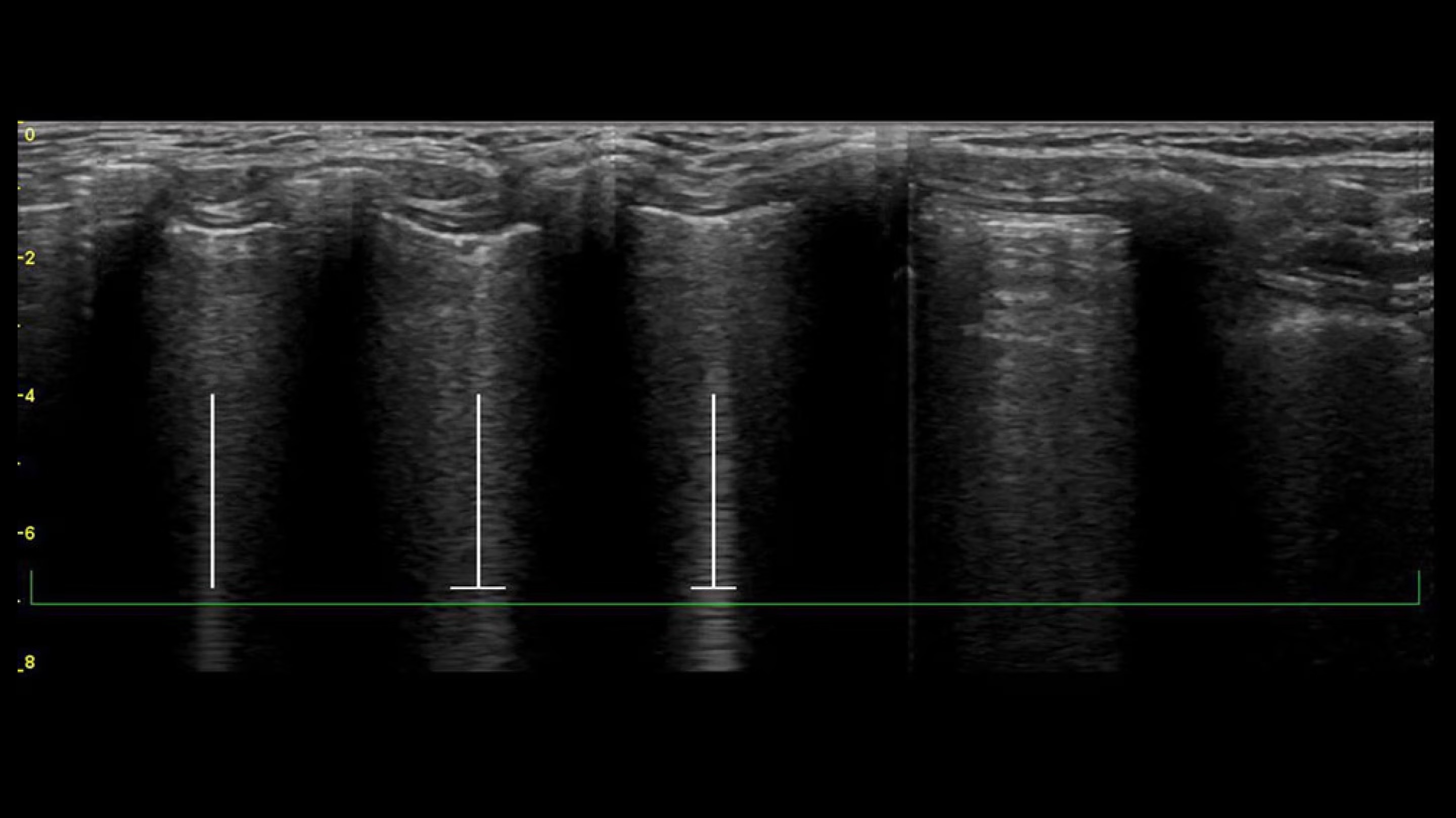 Product Media Carousel Image