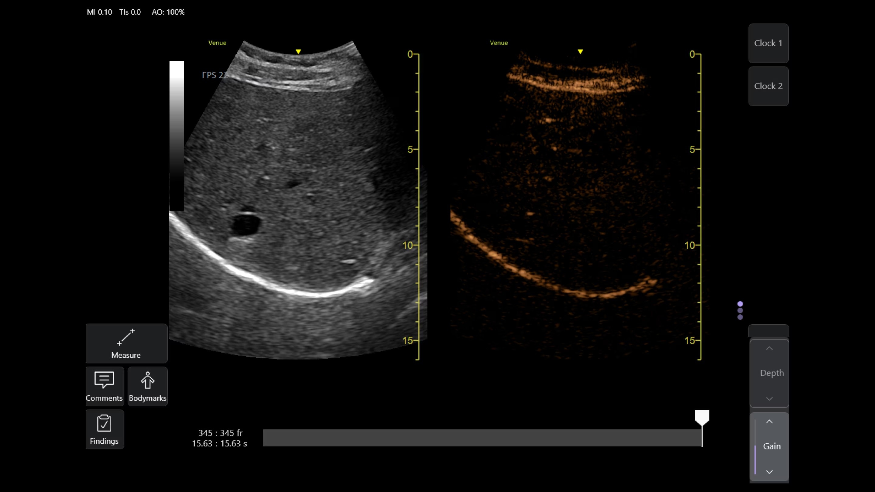 Product Media Carousel Image