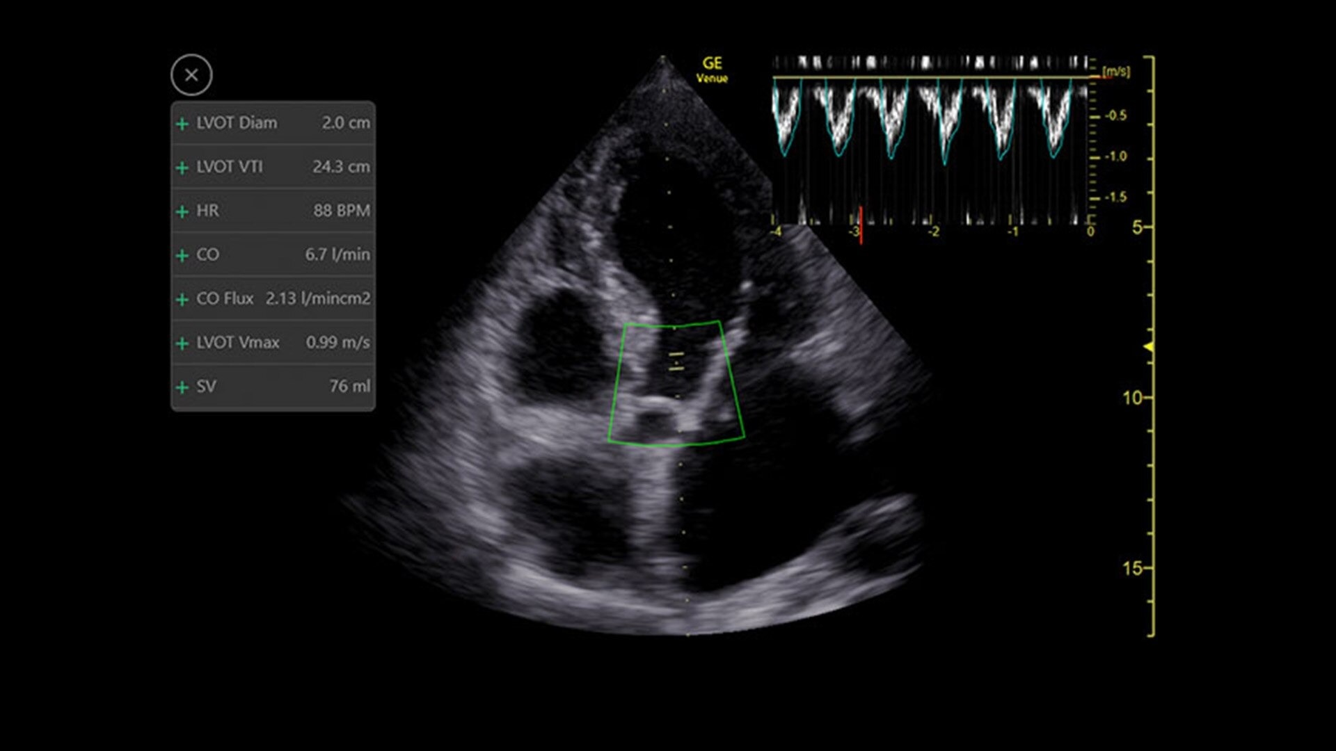 Product Media Carousel Image