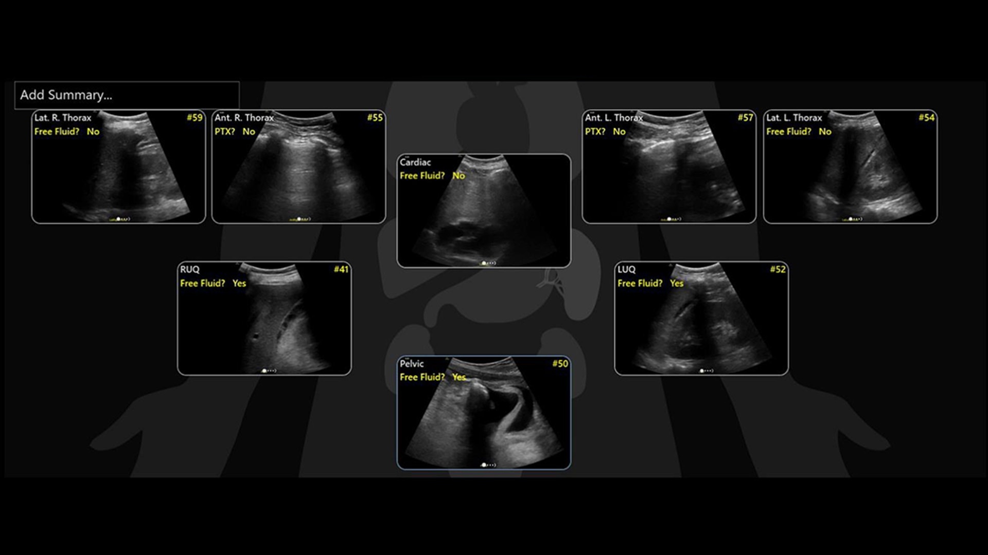 Product Media Carousel Image