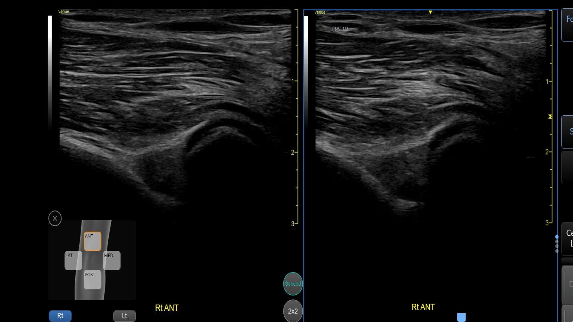 Product Media Carousel Image