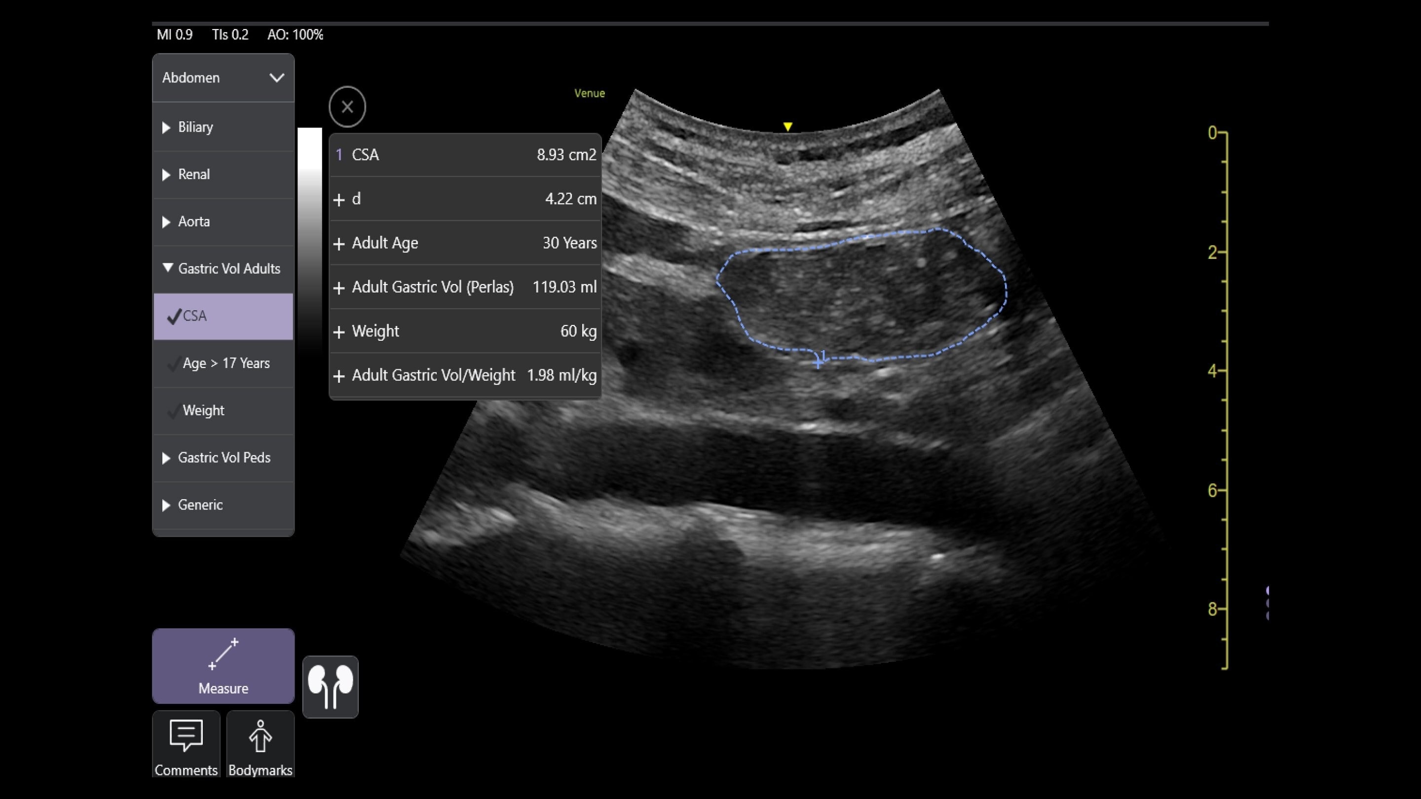 Product Media Carousel Image