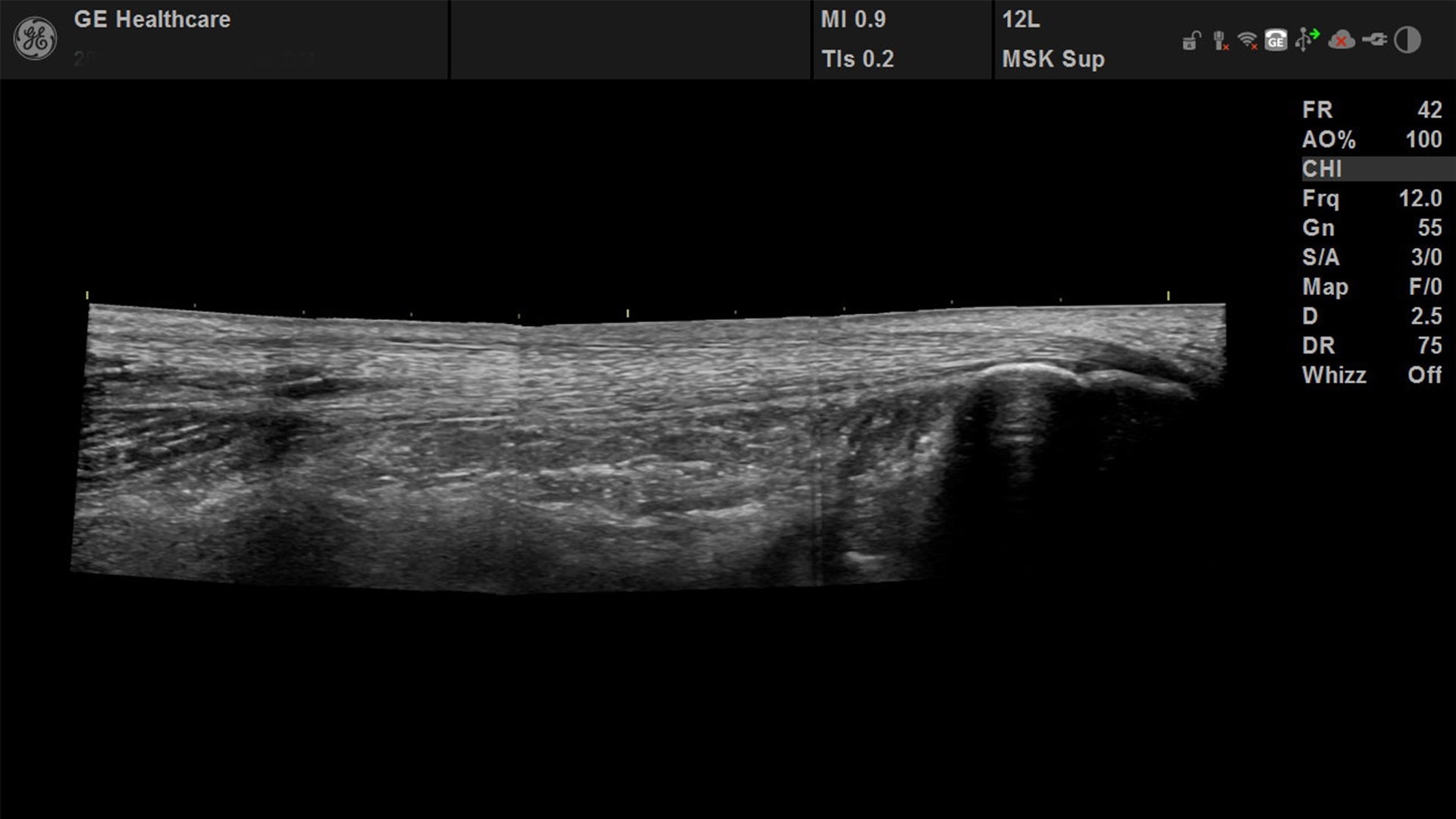 Product Media Carousel Image