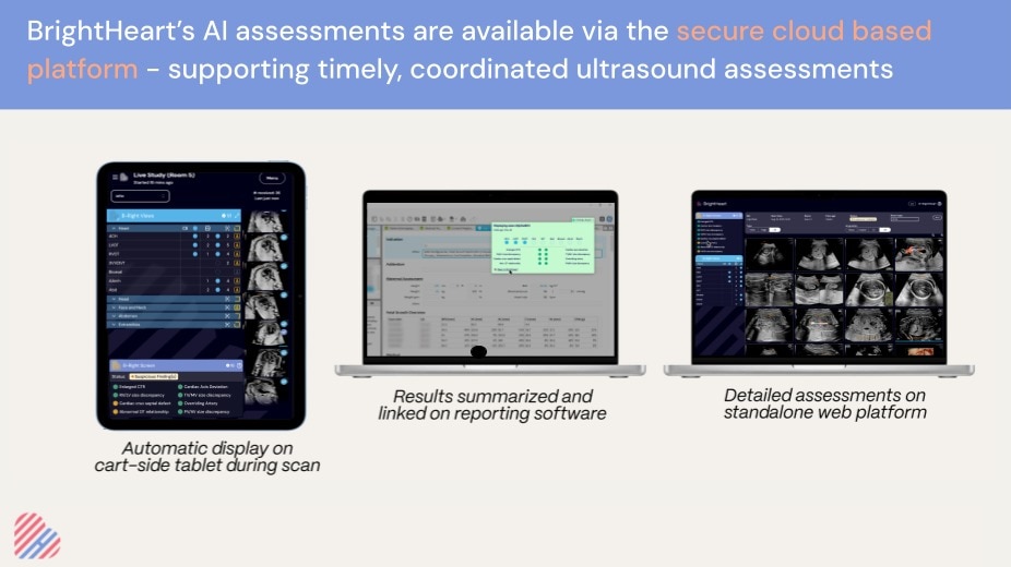 Product Media Carousel Image