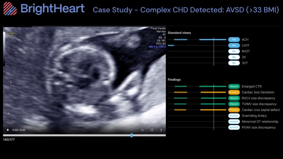 Product Media Carousel Image