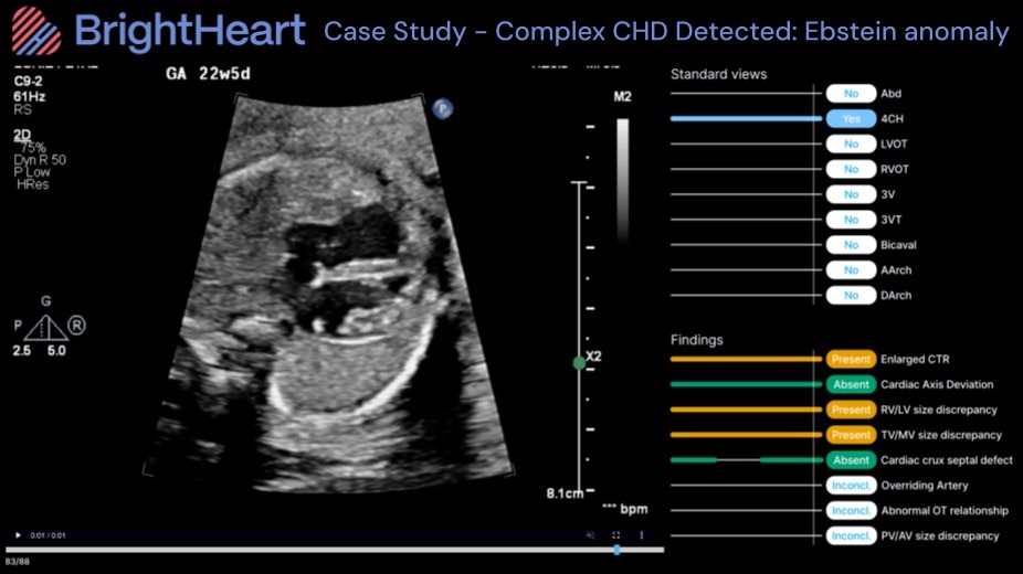 Product Media Carousel Image
