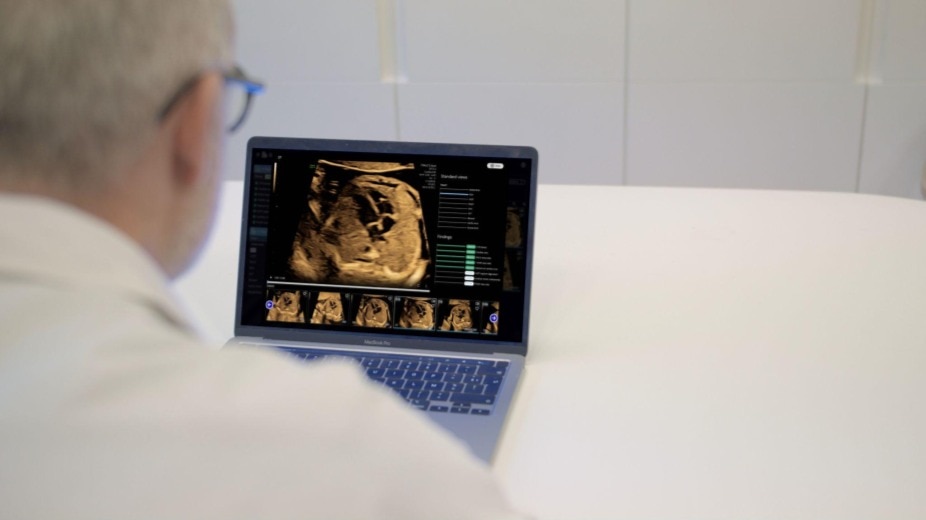 Product Media Carousel Image