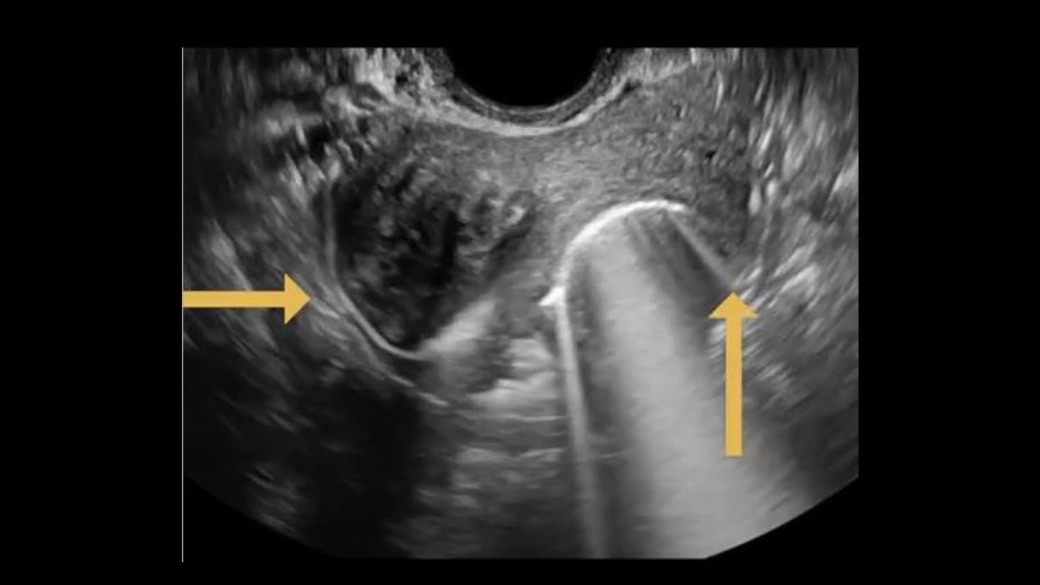 Product Media Carousel Image